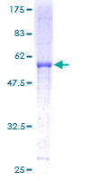 ab159787 on a 12.5% SDS-PAGE stained with Coomassie Blue.