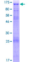 ab163171 on a 12.5% SDS-PAGE stained with Coomassie Blue.