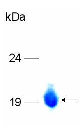 ab79555 15% SDS PAGE gel, Coomassie blue staining.