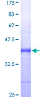 ab159135 on a 12.5% SDS-PAGE stained with Coomassie Blue.