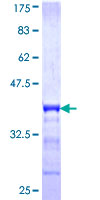 ab159771 on a 12.5% SDS-PAGE stained with Coomassie Blue.