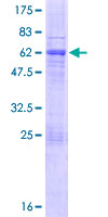 ab164287 on a 12.5% SDS-PAGE stained with Coomassie Blue.