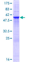 ab163254 on a 12.5% SDS-PAGE stained with Coomassie Blue.