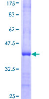 ab152951 on a 12.5% SDS-PAGE stained with Coomassie Blue.
