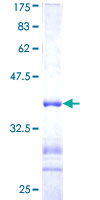 ab159977 on a 12.5% SDS-PAGE stained with Coomassie Blue.