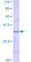 ab164443 on a 12.5% SDS-PAGE stained with Coomassie Blue.