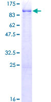 ab163618 on a 12.5% SDS-PAGE stained with Coomassie Blue.