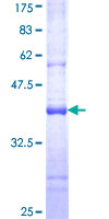 ab163619 on a 12.5% SDS-PAGE stained with Coomassie Blue.