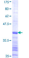 ab163625 on a 12.5% SDS-PAGE stained with Coomassie Blue.
