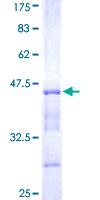 ab159783 on a 12.5% SDS-PAGE stained with Coomassie Blue.