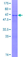 ab164734 on a 12.5% SDS-PAGE stained with Coomassie Blue.