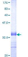 ab164735 on a 12.5% SDS-PAGE stained with Coomassie Blue.
