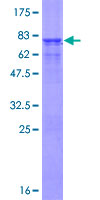 ab163894 on a 12.5% SDS-PAGE stained with Coomassie Blue.