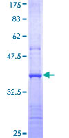 ab163895 on a 12.5% SDS-PAGE stained with Coomassie Blue.