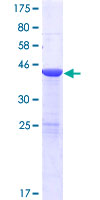 ab162936 on a 12.5% SDS-PAGE stained with Coomassie Blue.
