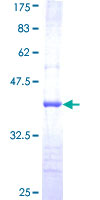 ab162937 on a 12.5% SDS-PAGE stained with Coomassie Blue.