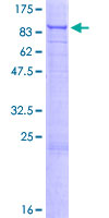 ab161815 on a 12.5% SDS-PAGE stained with Coomassie Blue.