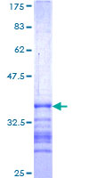 ab161816 on a 12.5% SDS-PAGE stained with Coomassie Blue.