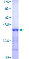 ab160339 on a 12.5% SDS-PAGE stained with Coomassie Blue.