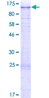 ab160623 on a 12.5% SDS-PAGE stained with Coomassie Blue.