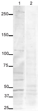 All lanes : Anti-USP9x antibody ( ab19879 ) at 1 µg/ml Lane 1 : Caco 2 (Human colonic carcinoma cell line) Whole Cell Lysate ( ab3950 ) Lane 2 : Caco 2 (Human colonic carcinoma cell line) Whole Cell Lysate ( ab3950 ) with Human USP9x peptide (ab20617) at 1 µg/ml Lysates/proteins at 20 µg per lane. Secondary Alexa Fluor Goat polyclonal to Rabbit IgG (700) at 1/5000 dilution developed using the ECL technique Performed under reducing conditions. Predicted band size : 54, 100,105 , 290 kDa Observed band size : 100,105,290 kDa ( why is the actual band size different from the predicted? ) Additional bands at : ~50-65 kDa. We are unsure as to the identity of these extra bands.