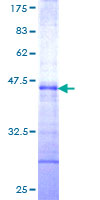 ab160880 on a 12.5% SDS-PAGE stained with Coomassie Blue.