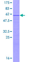 ab162423 on a 12.5% SDS-PAGE stained with Coomassie Blue.