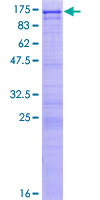 ab161167 on a 12.5% SDS-PAGE stained with Coomassie Blue.