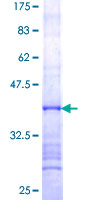 ab161168 on a 12.5% SDS-PAGE stained with Coomassie Blue.