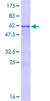 ab164505 on a 12.5% SDS-PAGE stained with Coomassie Blue.