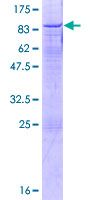 ab162413 on a 12.5% SDS-PAGE stained with Coomassie Blue.