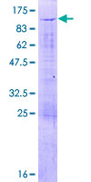 ab163468 on a 12.5% SDS-PAGE stained with Coomassie Blue.