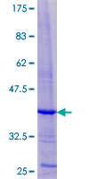 ab166080 on a 12.5% SDS-PAGE stained with Coomassie Blue.