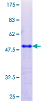 ab159792 on a 12.5% SDS-PAGE stained with Coomassie Blue.