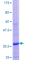 ab160282 on a 12.5% SDS-PAGE stained with Coomassie Blue.