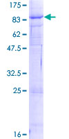 ab164369 on a 12.5% SDS-PAGE stained with Coomassie Blue.