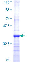 ab164370 on a 12.5% SDS-PAGE stained with Coomassie Blue.