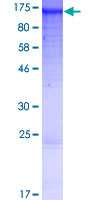 ab164491 on a 12.5% SDS-PAGE stained with Coomassie Blue.