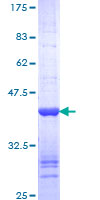 ab159795 on a 12.5% SDS-PAGE stained with Coomassie Blue.