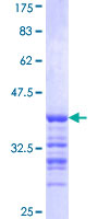 ab164200 on a 12.5% SDS-PAGE stained with Coomassie Blue.