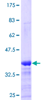ab159796 on a 12.5% SDS-PAGE stained with Coomassie Blue.