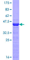ab159797 on a 12.5% SDS-PAGE stained with Coomassie Blue.