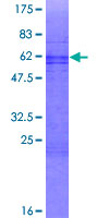 ab162133 on a 12.5% SDS-PAGE stained with Coomassie Blue.