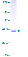 ab162962 on a 12.5% SDS-PAGE stained with Coomassie Blue.