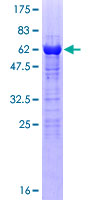 ab160607 on a 12.5% SDS-PAGE stained with Coomassie Blue.