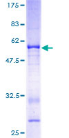 ab162552 on a 12.5% SDS-PAGE stained with Coomassie Blue.