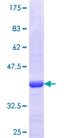 ab162553 on a 12.5% SDS-PAGE stained with Coomassie Blue.