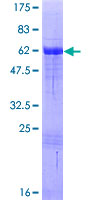 ab166004 on a 12.5% SDS-PAGE stained with Coomassie Blue.