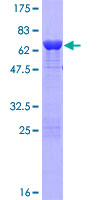 ab160858 on a 12.5% SDS-PAGE stained with Coomassie Blue.