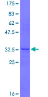 ab159804 on a 12.5% SDS-PAGE stained with Coomassie Blue.